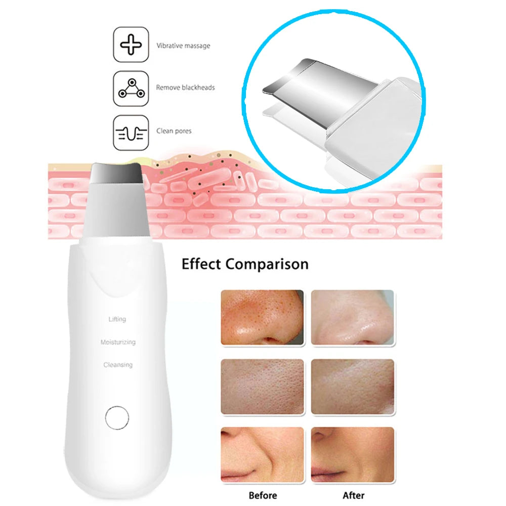 Scrubber Black Head Remover